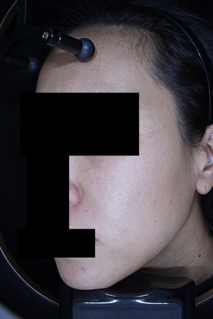 치료후기 이미지