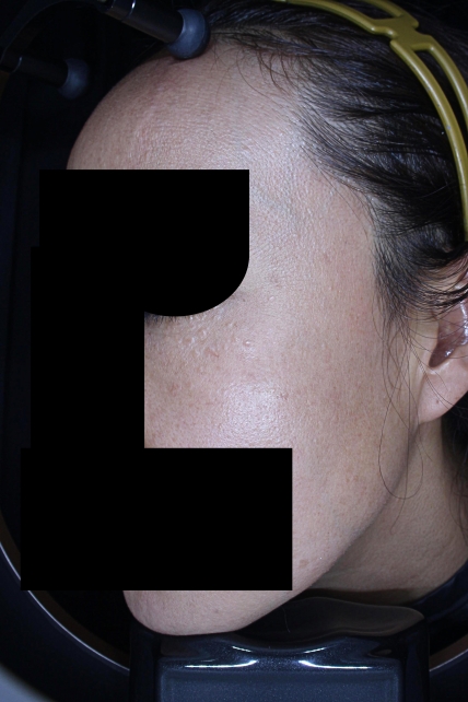 치료후기 이미지