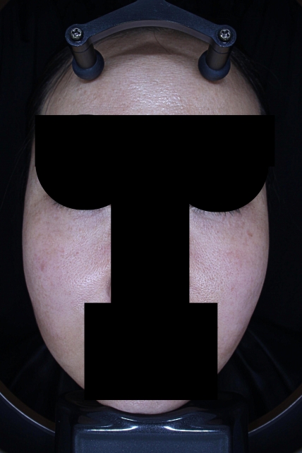 치료후기 이미지