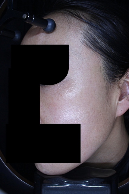 치료후기 이미지